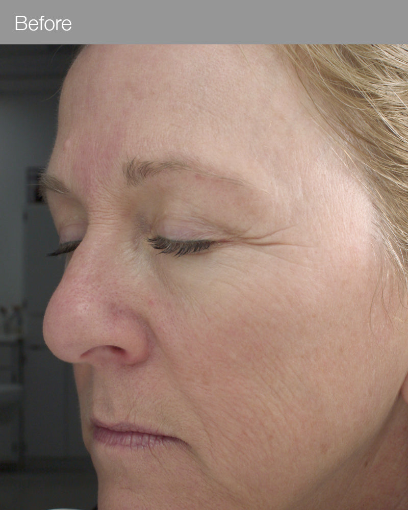 Marini Retinol Plus