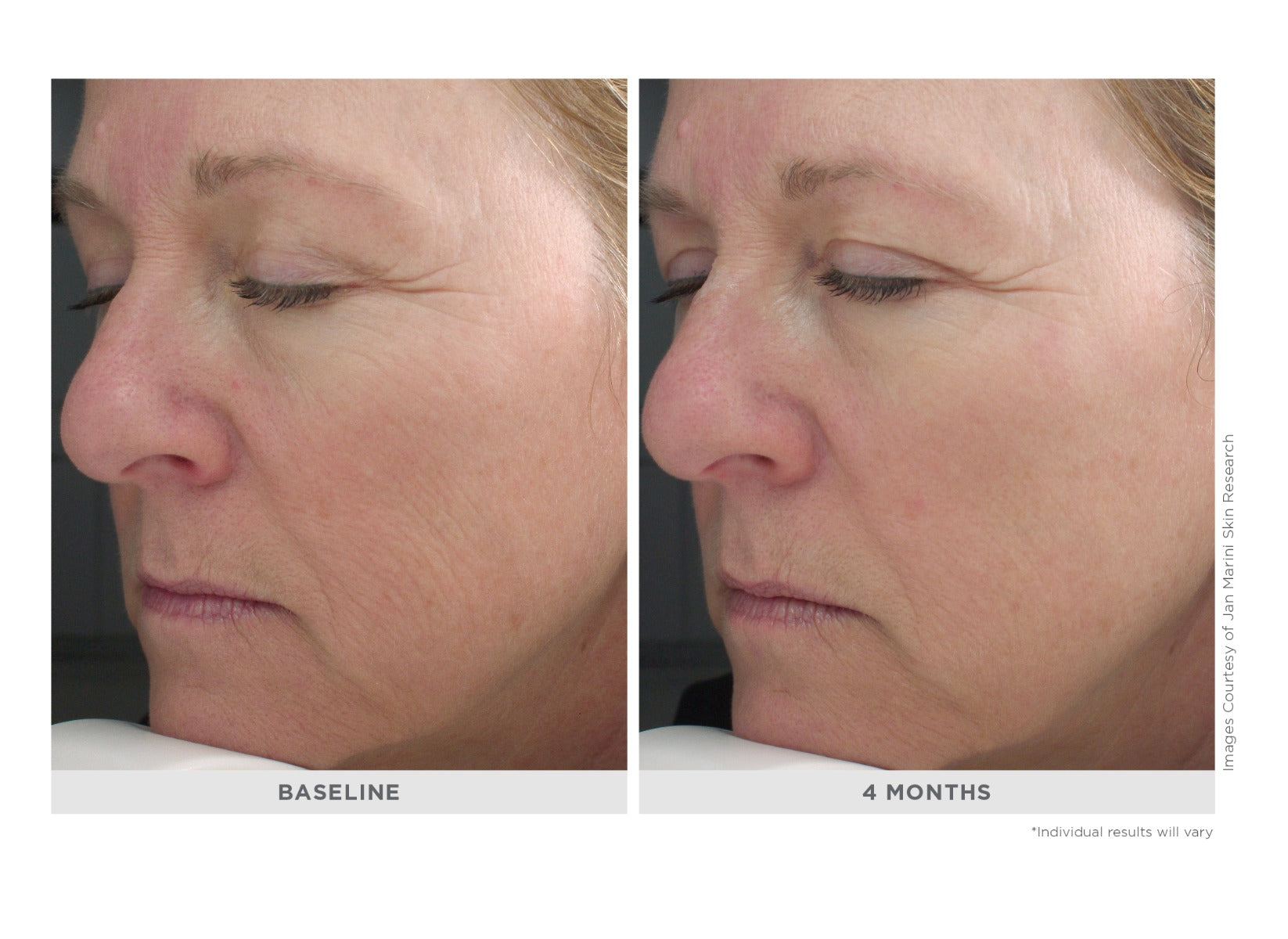 Marini Regeneration Booster-Peptides/Growth Factors