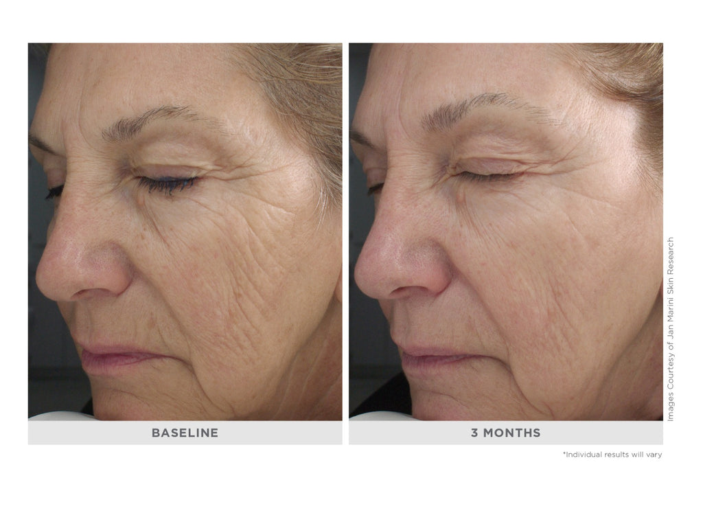 Marini Retinol Plus