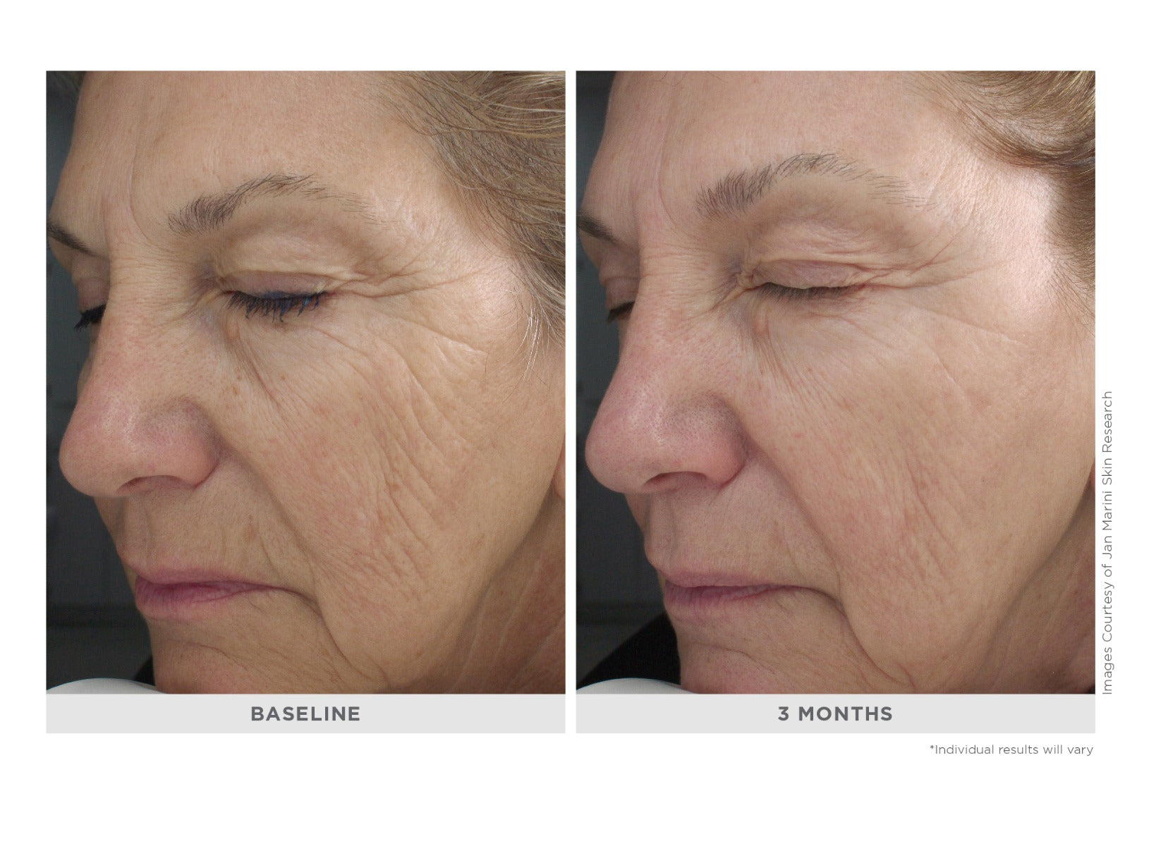 Marini Retinol Plus