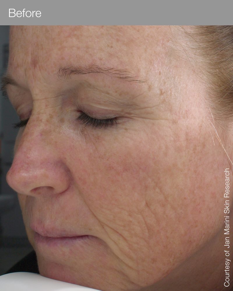 Marini Retinol Plus