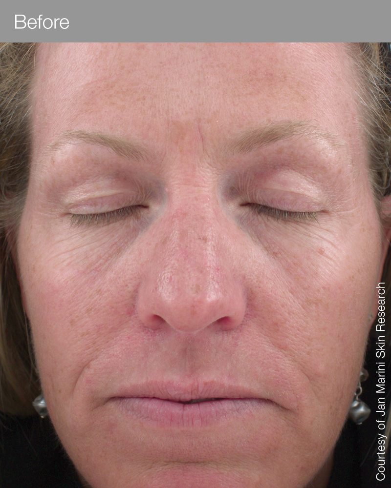 Marini Regeneration Booster-Peptides/Growth Factors