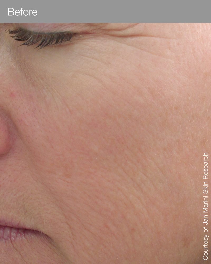 Marini Regeneration Booster-Peptides/Growth Factors